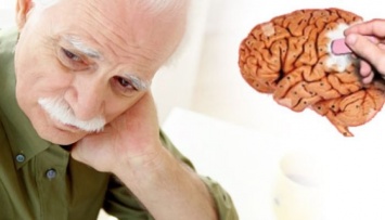 Ученые: В 2100 году каждый второй житель Земли заболеет синдромом Альцгеймера