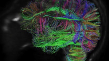 Нейрофизиологи утверждают, что забывать лишнюю информацию полезно