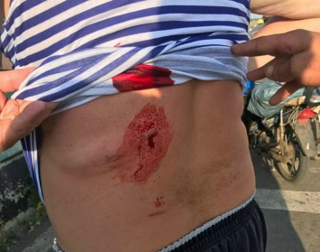 Около КПВВ Марьинка гражданский получил огнестрельное ранение