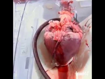 Ученые уверены, что клетки сердца после инфаркта можно обновить