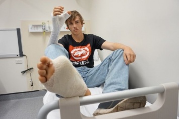Австралийцу пересадили на руку большой палец от ноги