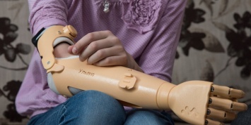 Компания «Моторика» ищет белорусских детей для бесплатного протезирования