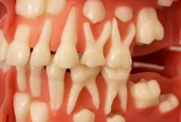 НОВОСТЬ ДНЯ! Стало возможным вырастить зубы станет в любом возрасте!