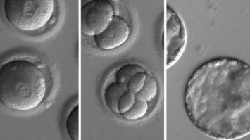 Ученые из США впервые успешно отредактировали геном эмбриона человека