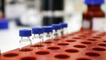 Испытания российской вакцины от Эболы начались в Гвинее