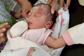 В Индонезии пытались похоронить вживую младенца. Врачи его спасли
