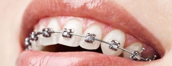 В Херсоне подростка 5 часов "морили" в стоматологии