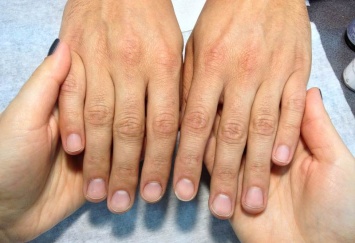 Длина пальцев рук может предсказать спортивные способности
