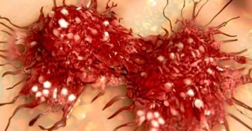 Ученые доказали, что негатив буквально заставляет рак расти внутри тела