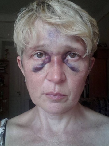 Тенденция насилия: в Одессе избивают активистов, выступающих против мэра Труханова