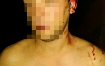 В Запорожье изрезали мужчину (ФОТО)