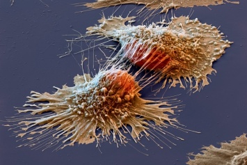 Эколог назвала бытовые вещи, которые могут спровоцировать рак