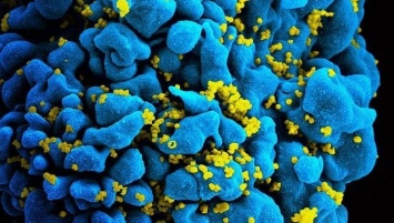 Ученые создали иммунные клетки, способные бороться с ВИЧ