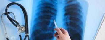 В Мариуполе снижается уровень заболеваемости туберкулезом