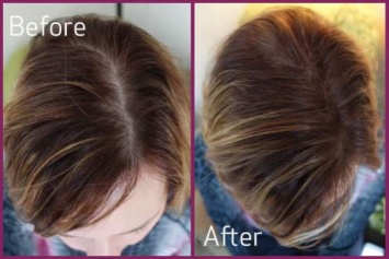 4 естественных способа восстановления волос за 10 дней