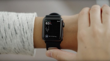 Следующее поколение Apple Watch могут оснастить датчиком ЭКГ