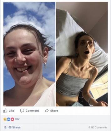 Муж выставил фото больной жены перед смертью (фото)