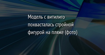 Модель с витилиго похвасталась стройной фигурой на пляже (фото)