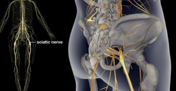 3 упражнения для лечения боли седалищного нерва, бедер и спины