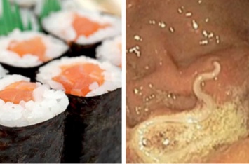 Любите суши? Эти опасные черви, вероятно, внутри вас