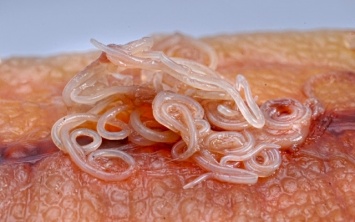 Херсонцы болеют паразитами из-за суши и шашлыка