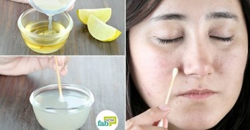 5 способов удаления темных пятен с помощью лимонного сока