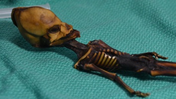 Ученые расшифровали ДНК миниатюрного "пришельца" из пустыни Атакама