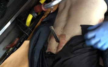 В Запорожье мужчина изрезал ножом товарища, а потом скрылся на машине (ФОТО 18+)