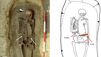 В Италии обнаружили средневекового "киборга"
