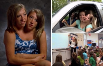 Удивительные 28-летние сестры делят одно тело и одну зарплату преподавателя (видео)