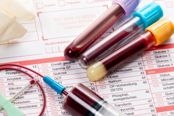 Анализ крови может определить срок жизни человека