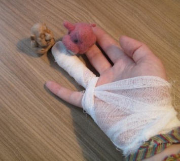 В Оренбургской области змея укусила мальчика за палец руки