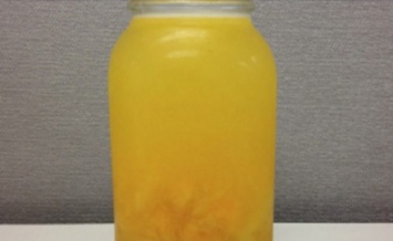 Если вы пьете лимонную воду утром, добавьте к ней ананас. Это важно!