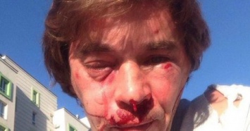 Под Киевом избили активиста, который борется против застройки парка в Вишневом (фото)