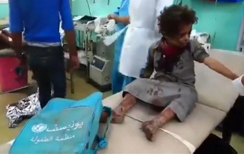 В Йемене авиация обстреляла автобус с детьми
