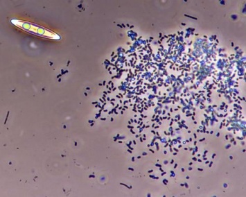 Ученые нашли способ выращивать «неуловимые бактерии-паразиты»