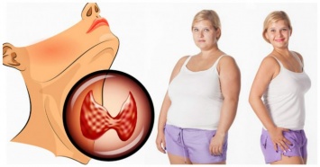 Как похудеть, если у вас гипоактивная работа щитовидной железы