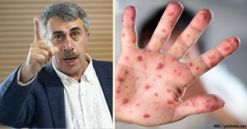 Умрет каждый 10-й: Доктор Комаровский предупреждает о вспышке новой инфекции