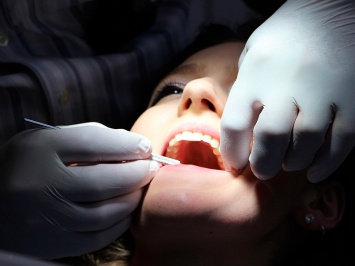 Исследование: болезни зубов преследуют людей на протяжении всей эволюции
