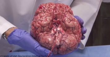 Вот реальный мозг реального человека, который пожертвовал его науке