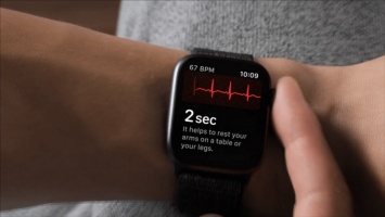 Насколько эффективна функция снятия ЭКГ в Apple Watch Series 4? Мнение врача