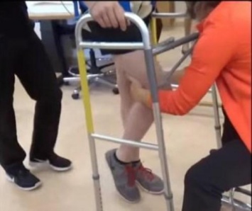 Ученые: Имплантант спинного мозга помогает парализованным вновь ходить