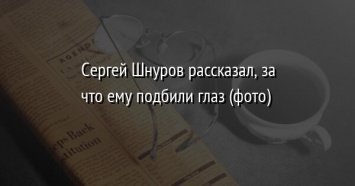 Сергей Шнуров рассказал, за что ему подбили глаз (фото)