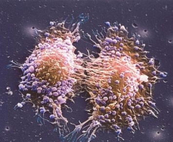 ИИ: врачи смогут предсказывать мутацию раковых клеток и персонализировать лечение
