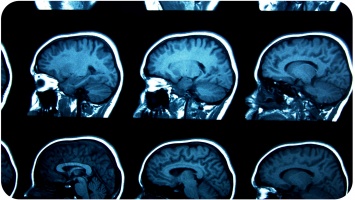 Ученые разгадали 125-летнюю тайну мозга, которая поможет лечить эпилепсию