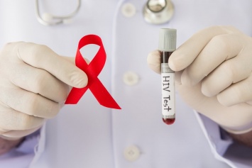 Экспресс-тест: в Одессе можно бесплатно провериться на ВИЧ за 15 минут