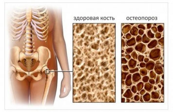 В Новосибирске медики спасли жизнь мужчине с исчезающим черепом