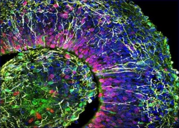 Ученые вырастили схожий с младенческим мини-мозг