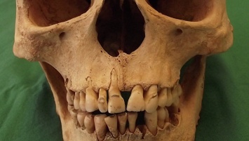 Ученые опровергли миф о "плохих зубах" средневековых европейцев
