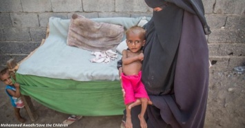 Голод в Йемене унес жизни 85 000 детей. Почему весь мир молчит?!